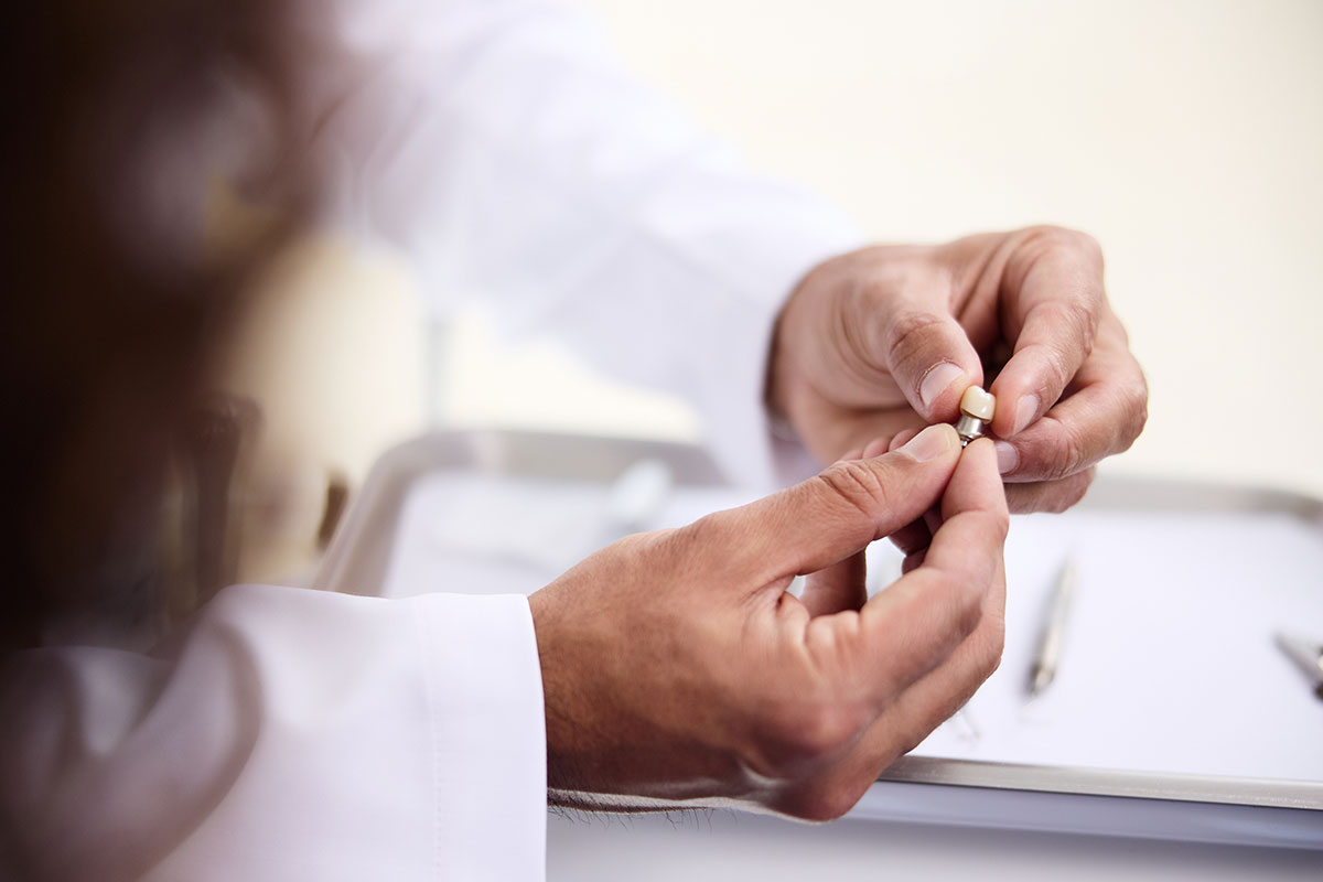 Photo of a tooth used in dental bridges in Orlando.